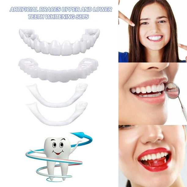 🦷✨ CARILLAS DENTALES PERFECTA SONRISA 😁💎